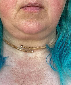 Close-up of a woman with turquoise hair wearing a choker necklace with metal accents, with her face partially visible.