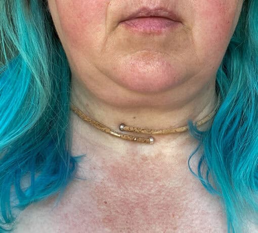 Close-up of a woman with turquoise hair wearing a choker necklace with metal accents, with her face partially visible.